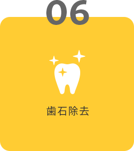 06 歯石除去